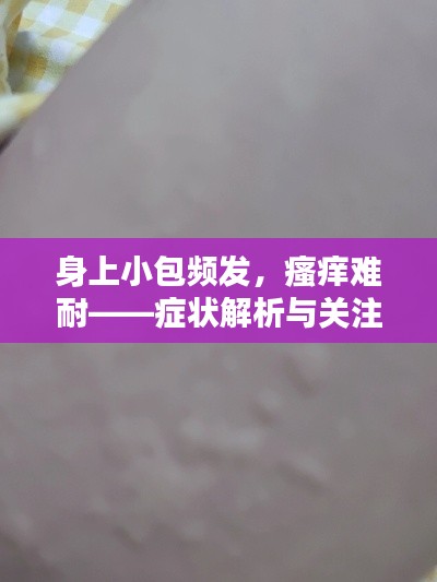 身上小包频发,瘙痒难耐——症状解析与关注