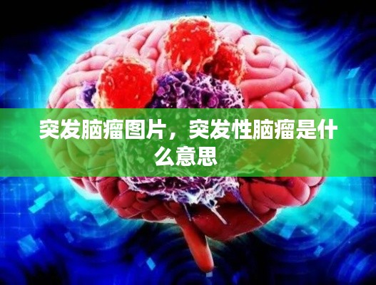 突发脑瘤图片,突发性脑瘤是什么意思